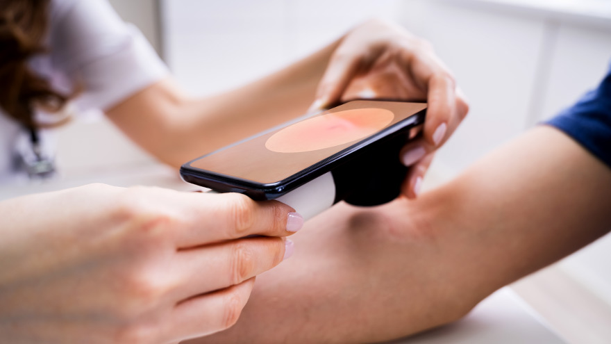 Female Doctor Examining Pigmented Skin Of Male Patient